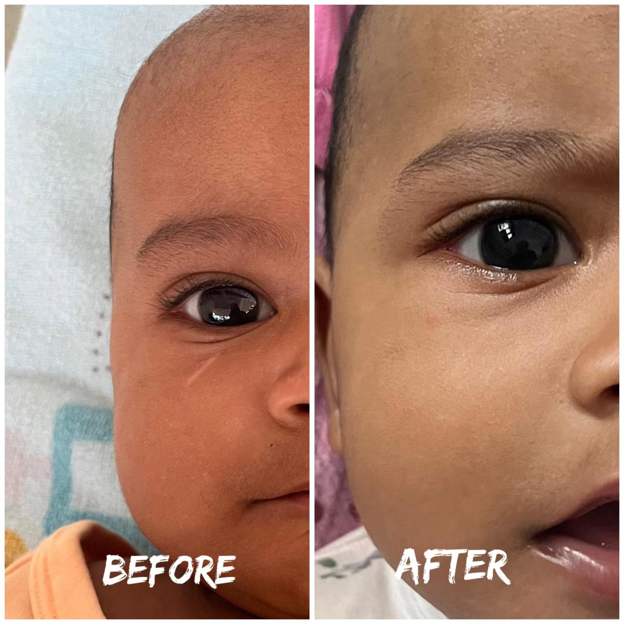 Transformation Result 3